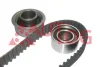 Комплект ГРМ Tucson/Sportage 2.0i 04- (рем. Conti CT937) (натяжний 30mm) Autlog ZK1111 (фото 1)